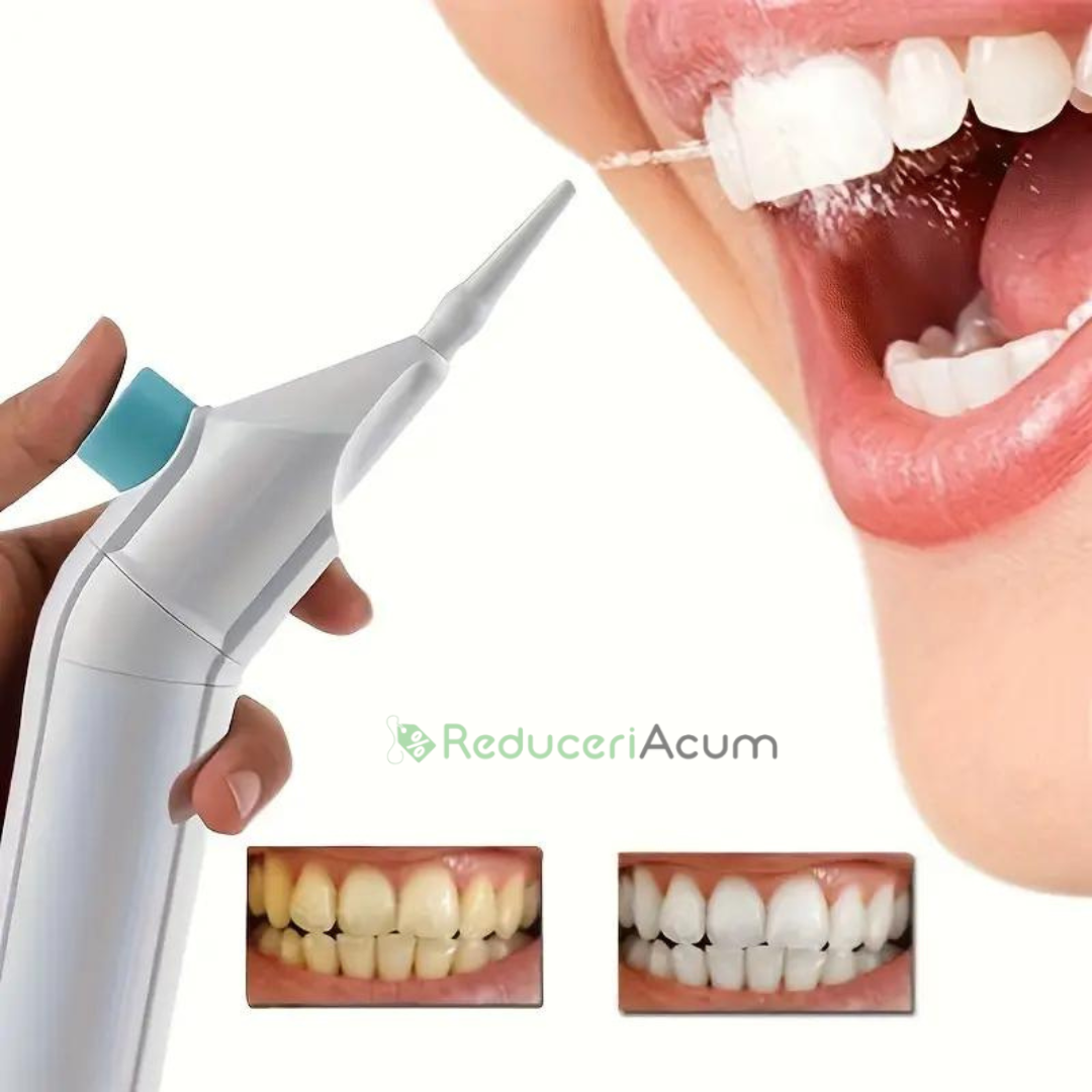 Irigator bucal pentru curatare dentara